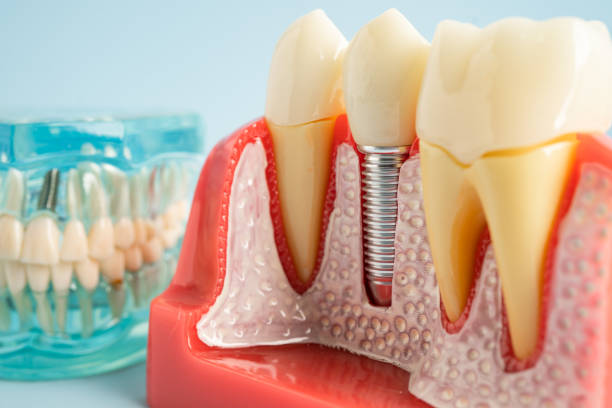 Best Dental Fillings (Composite and Amalgam)  in Greenlawn, NY